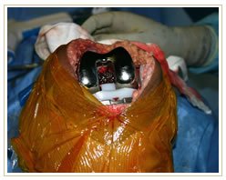 Slider image (8) Dr. A. K. Venkatachalam MJRC Clinic